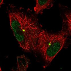 Katanin p60 Antibody, Novus Biologicals:Antibodies:Primary Antibodies